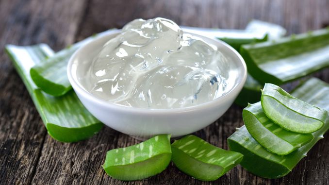 Aloe vera How to Treat Your Dandruff