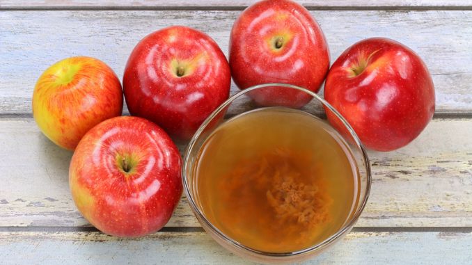 Apple Cider Vinegar How to Treat Your Dandruff