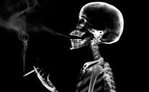 An X-Ray of a Smoker with a Cigarette