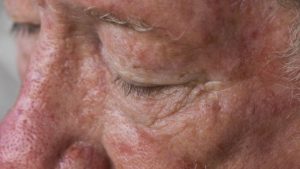 Make sunscreen your new best friend.