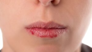 signs of diabetes