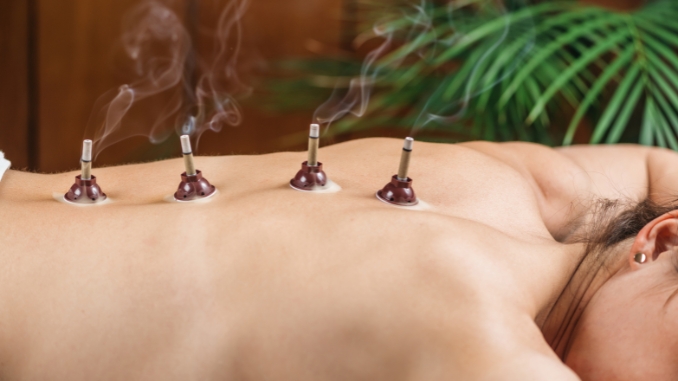 Different Types of Moxibustion Technique