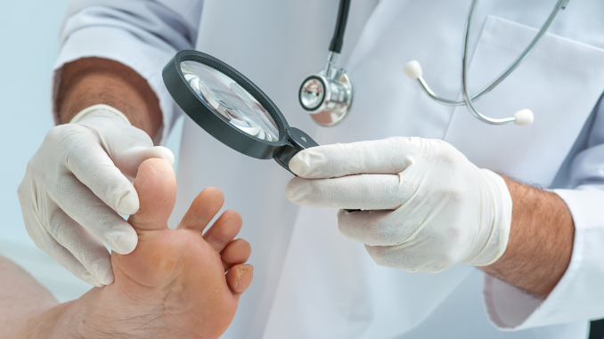 foot-doctor-dermatologist - how to know if toenail fungus is dying