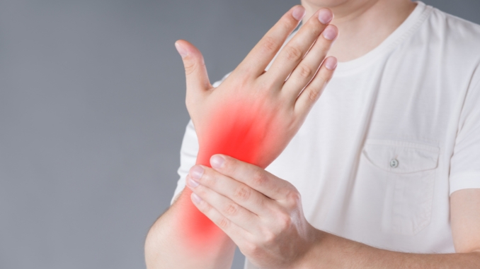 Carpal Tunnel Syndrome 