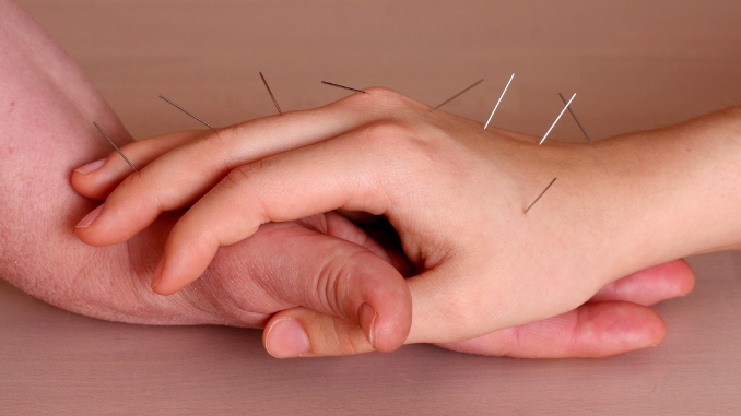 Acupuncture - Raynaud's Syndrome Test